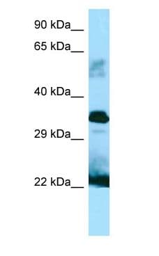 GH / Growth Hormone Antibody (aa117-166)