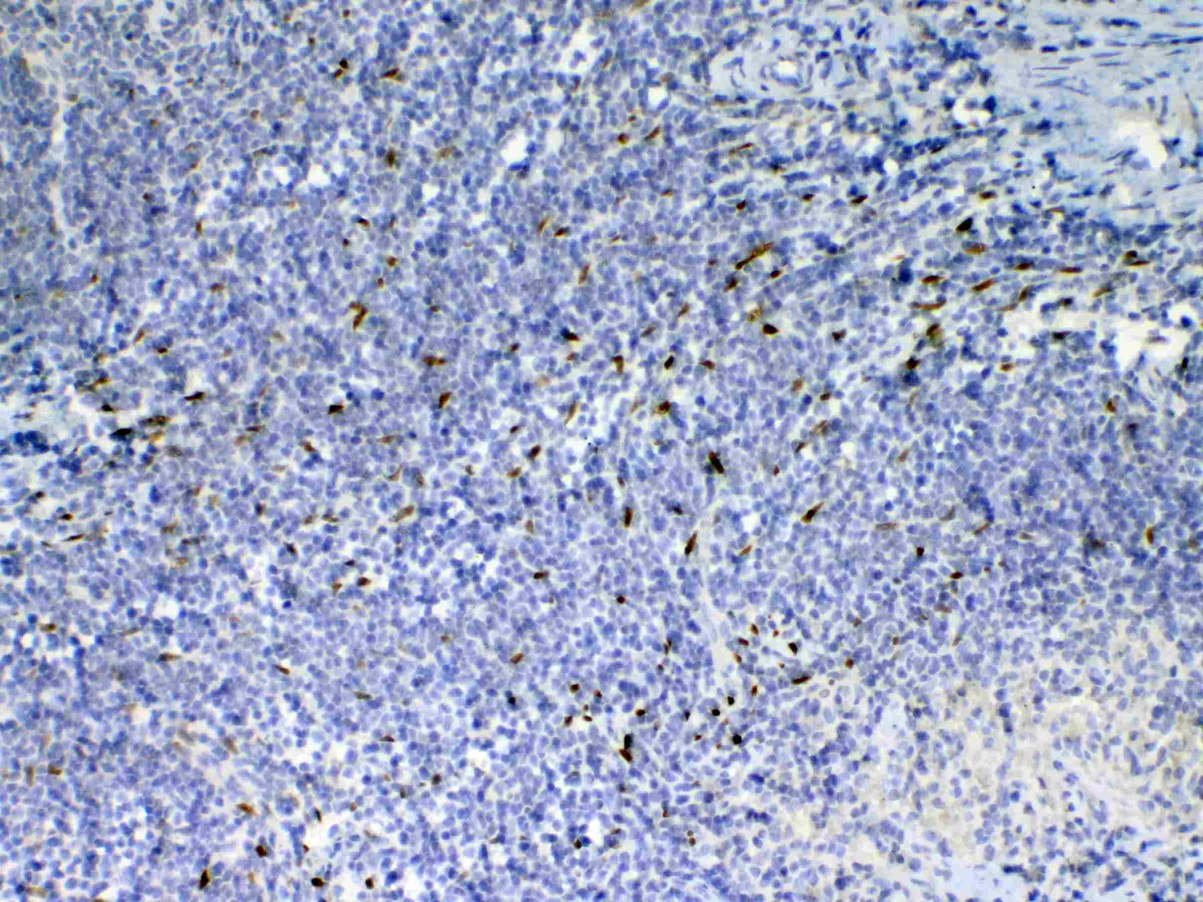Polyclonal Rabbit anti-Rat IL-33 Antibody (IHC, WB)