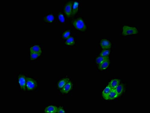 SLCO1B3 / OATP8 Antibody