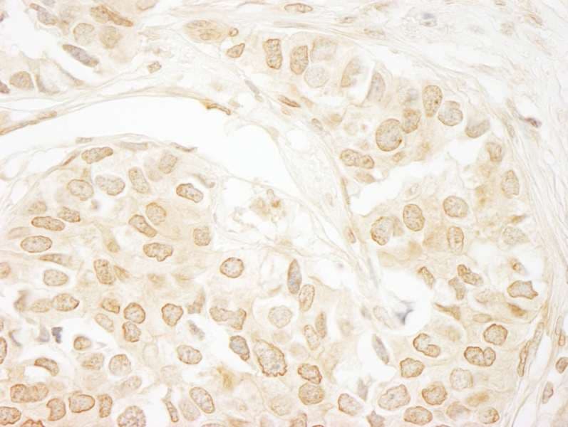 PPP3CA / CCN1 / Calcineurin A Antibody (aa1-50)