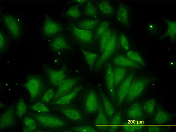 PathPlus™ Monoclonal Mouse anti-Human TIMP2 Antibody (clone 5B11, IHC, IF, WB)