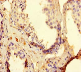 Polyclonal Rabbit anti-Human TDRD9 / HIG-1 Antibody
