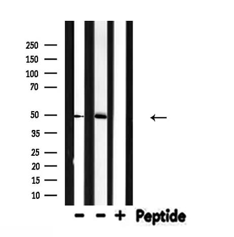 IL13RA2 / IL13R Alpha 2 Antibody