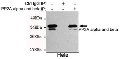 PP2CB / PPP2CB Antibody