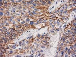 CTNNB1 / Beta Catenin Antibody (clone OTI6A3)