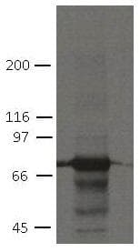 PKP1 / Plakophilin 1 Antibody (clone 19F10)