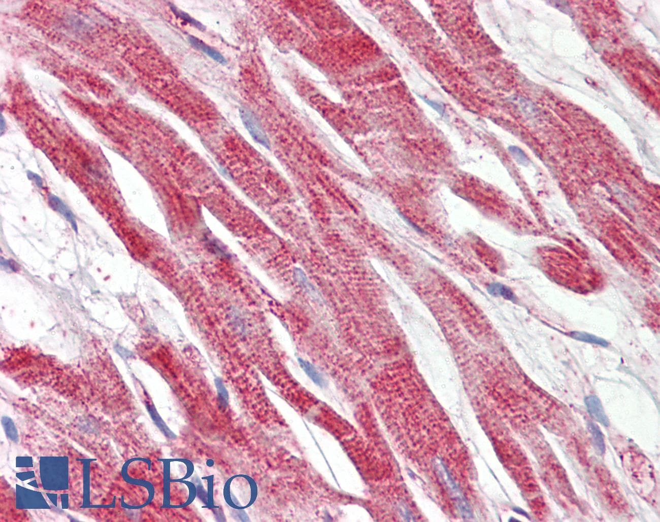 IHC-plus™ Polyclonal Goat anti-Human HAMP / Hepcidin Antibody (aa22-36, IHC)