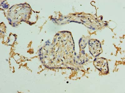 PKD1L2 Antibody