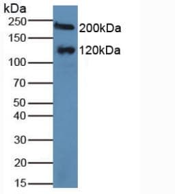 MGAM / Maltase-Glucoamylase Antibody (aa213-392)