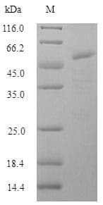 Influenza A Virus Hemagglutinin Protein (Recombinant 6His-SUMO, N-terminus)