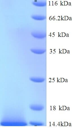 Human GUCA2B / Uroguanylin Protein (Recombinant His)
