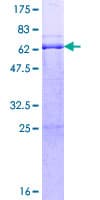 Human RFFL Protein (Recombinant GST)