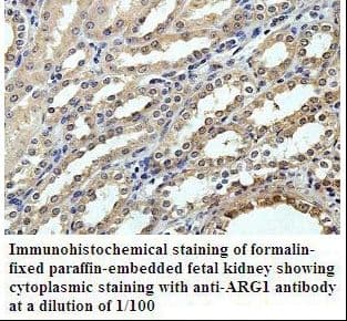 ARG1 / Arginase 1 Antibody (aa2-189)