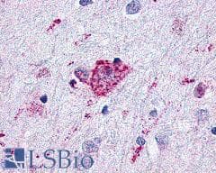 PathPlus™ GLP2R Antibody (C-Terminus)