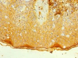 IL7R / CD127 Antibody (aa21-239)