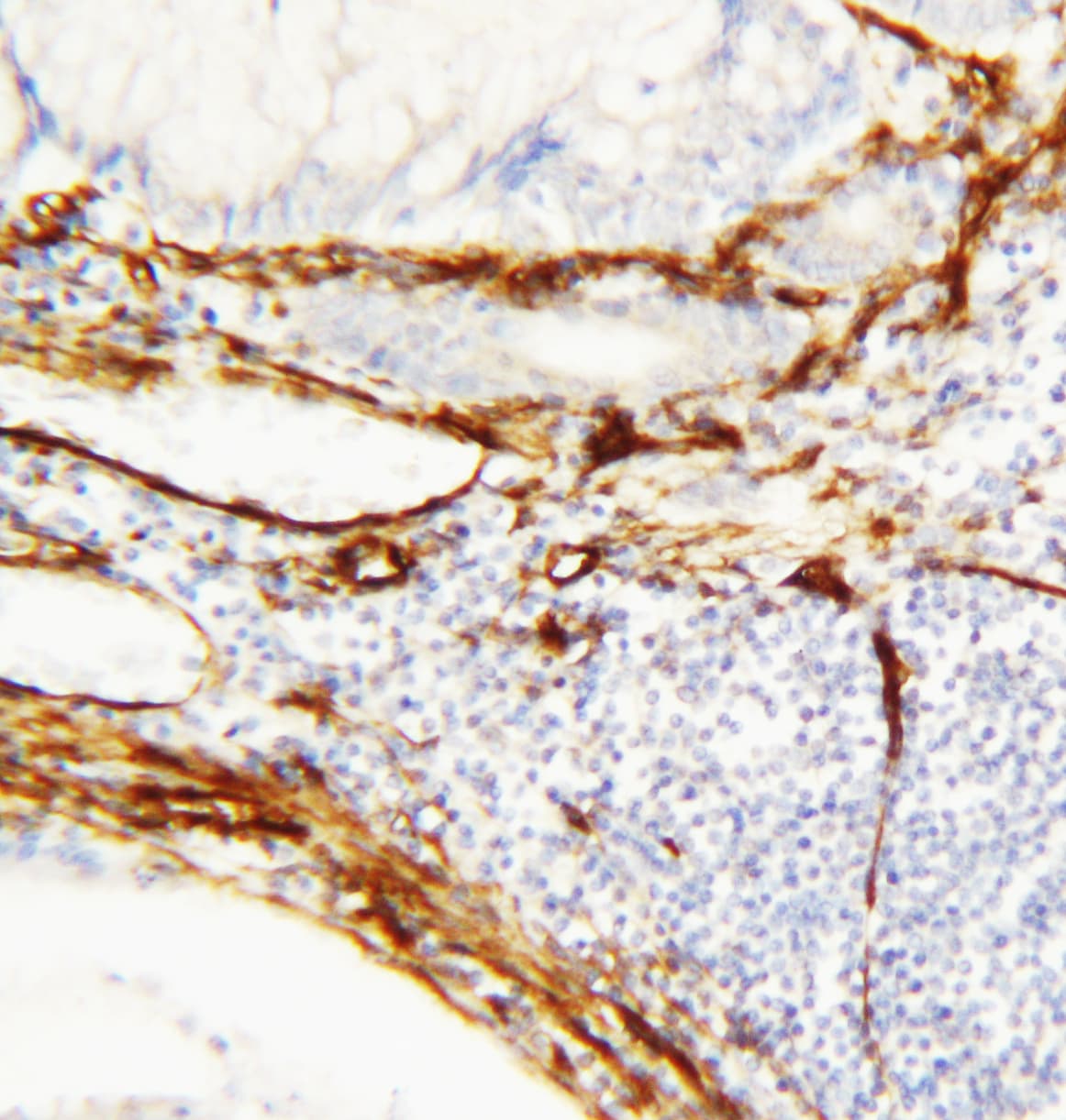 CAV1 / Caveolin 1 Antibody (aa164-178)