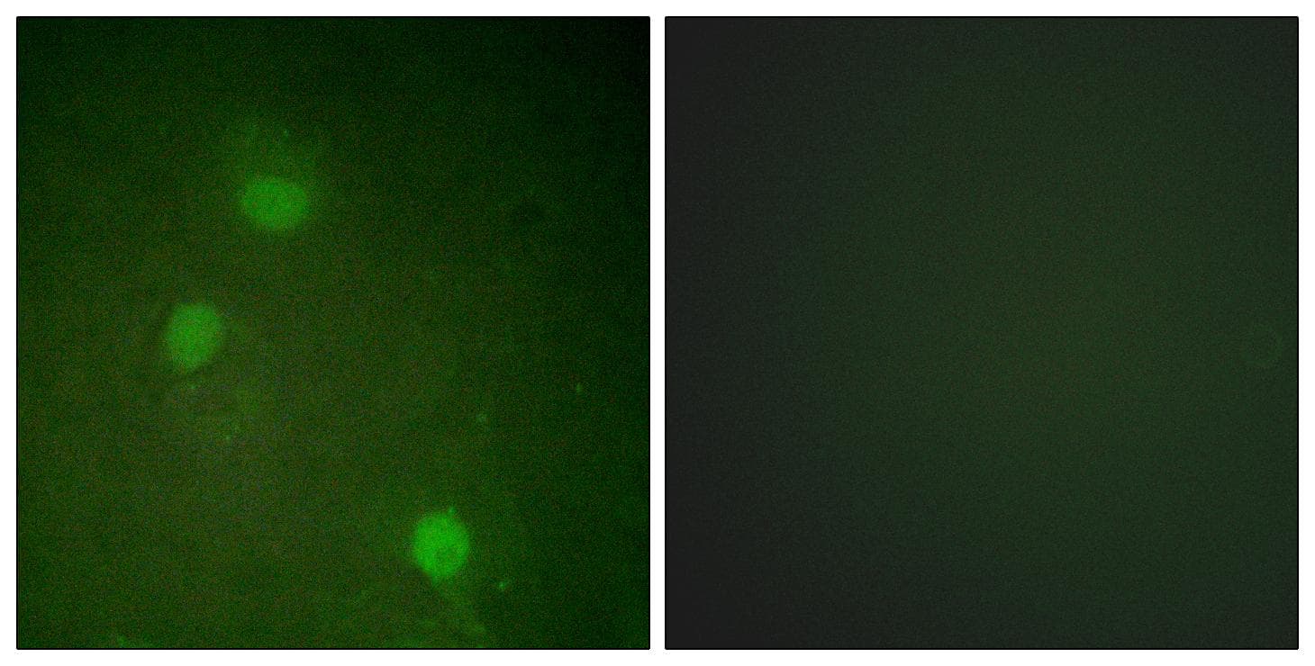 AURKB / Aurora-B Antibody (p232)