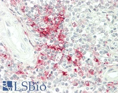 IHC-plus™ Monoclonal Mouse anti-Human MHC Class II Antibody (clone TDR31.1, Azide-free, IHC, WB)