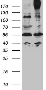 ABCC2 / MRP2 Antibody