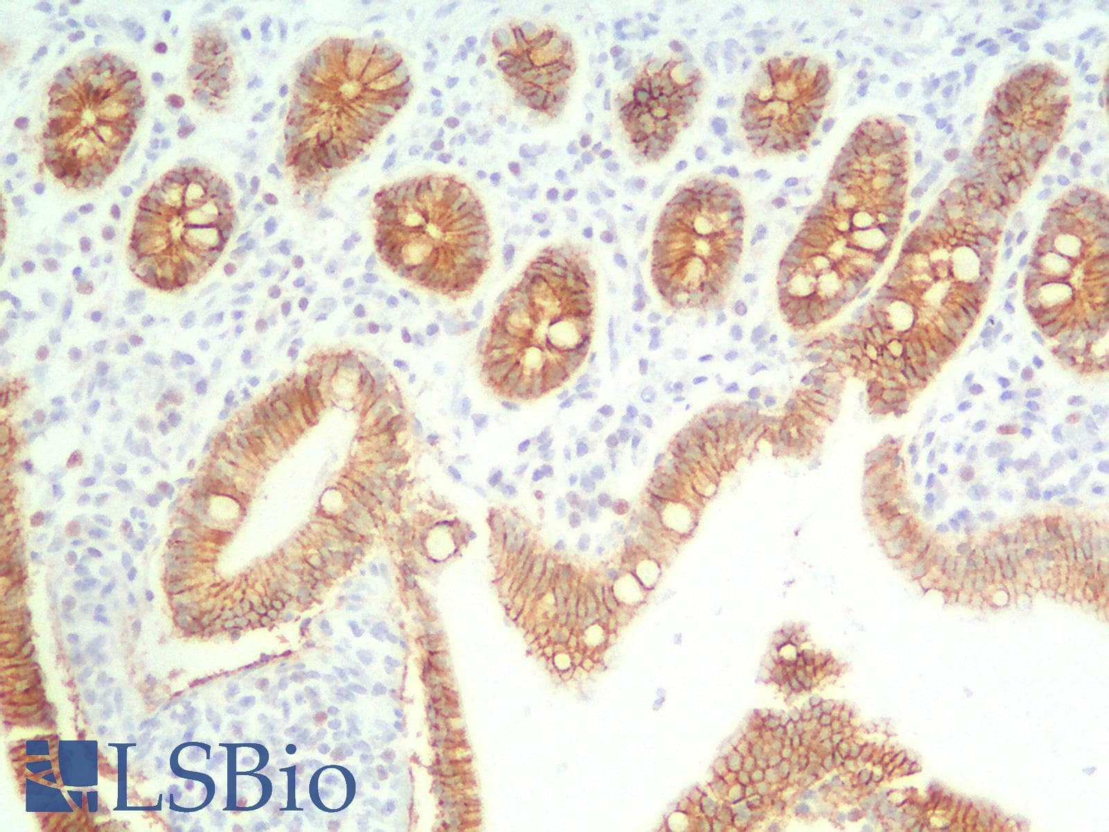 PathPlus™ Monoclonal Mouse anti-Human CDH1 / E Cadherin Antibody (Concentrated, IHC)