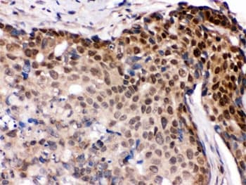 IRF5 Antibody