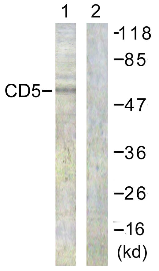 Polyclonal Rabbit anti-Human CD5 Antibody (aa421-470, WB)
