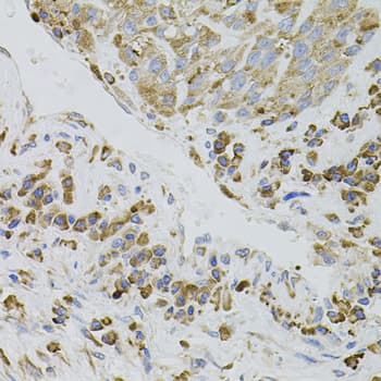 IRF1 / MAR Antibody