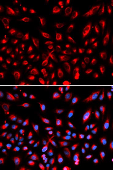 Polyclonal Rabbit anti-Human CLDN11 / Claudin 11 Antibody (IHC, IF, WB)