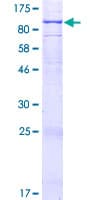 Human ADCK2 Protein (Recombinant GST)