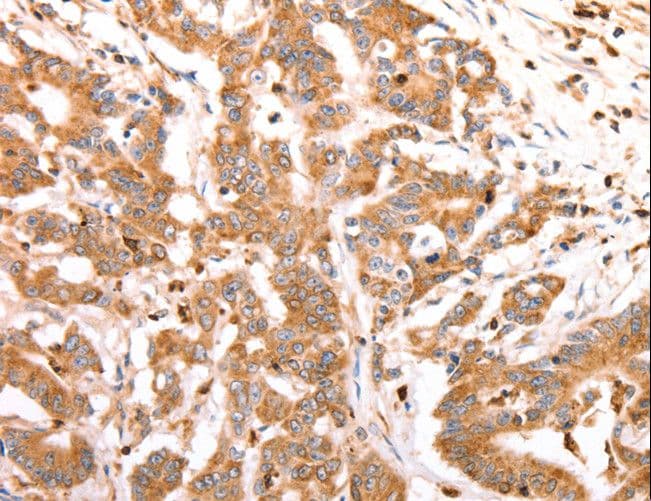CELSR2 Antibody