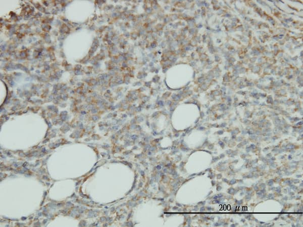 PROCR / EPCR Antibody (clone M2)
