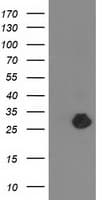 ZFAND2B Antibody (clone OTI1G10)