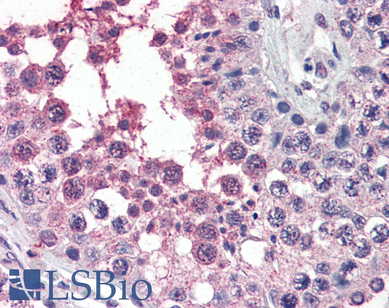 PathPlus™ ALK2 / ACVR1 Antibody (aa147-161)