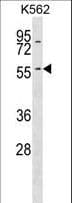 KRT6A / CK6A / Cytokeratin 6A Antibody (aa135-164)