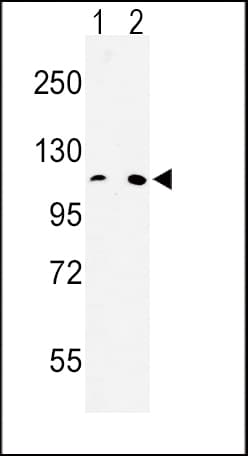MTTP / MTP Antibody (aa816-842)