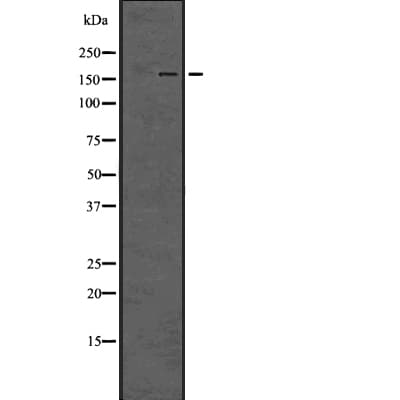 ARRB1 / Beta Arrestin 1 Antibody