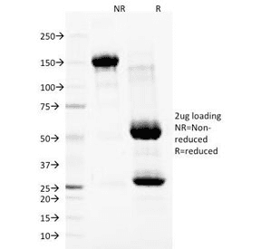 Monoclonal Mouse anti-Human Nuclear Membrane Marker NM97 Antibody (clone NM97, IF)