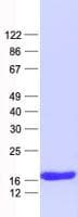 Human HBD / Hemoglobin Delta Protein (Recombinant His, N-Terminal)