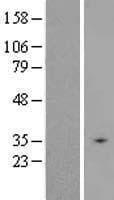 SLC25A31 Protein (Over-Expression Lysate Myc-DDK (Flag))
