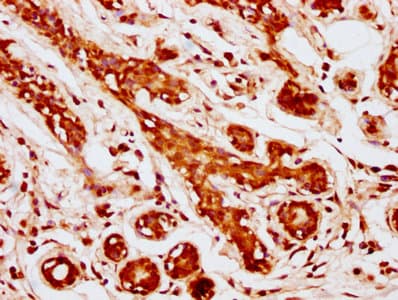 Polyclonal Rabbit anti-Human MOB1A Antibody (aa2-216, IHC, WB)