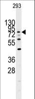 DYRK / DYRK1A Antibody (aa107-136)