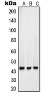 SFTPB / Surfactant Protein B Antibody (Internal)