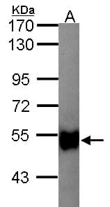 GK2 / Glycerol Kinase 2 Antibody (aa67-338)