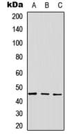 Polyclonal Rabbit anti-Human GPR143 Antibody (Internal, WB)