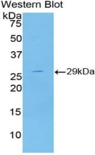 TUBD1 / Tubulin Delta Antibody (aa236-455, APC)