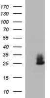 CHAC1 / MGC4504 Antibody (clone OTI1G2)