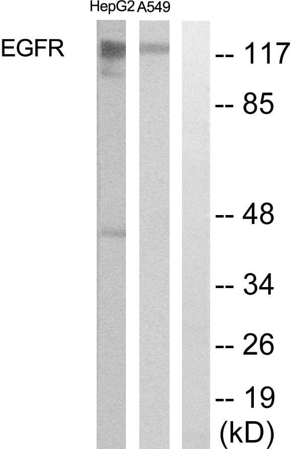 Polyclonal Rabbit anti-Human EGFR Antibody (IHC, WB)