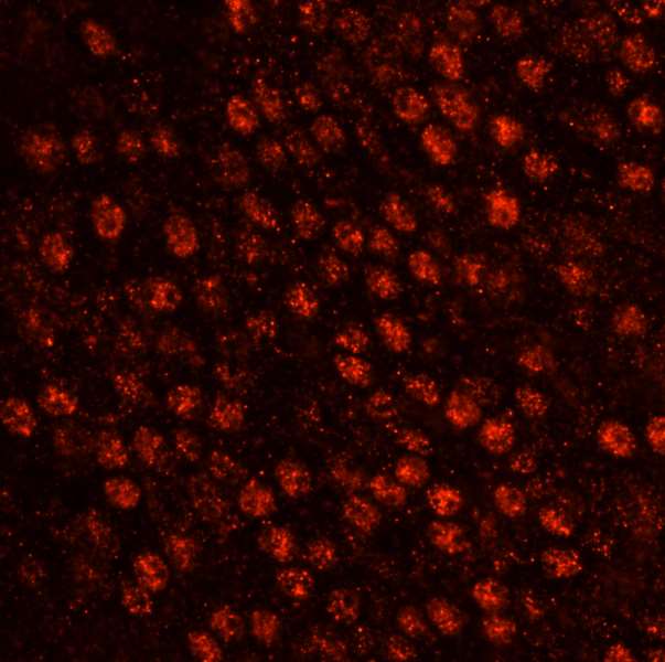 SART3 Antibody (aa600-650)
