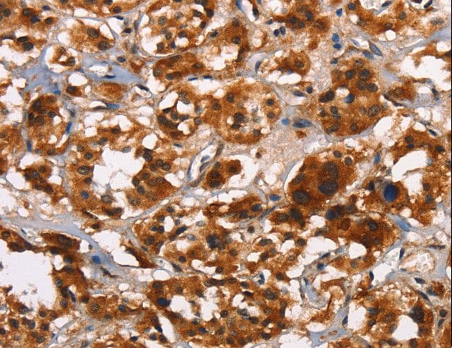 Polyclonal Rabbit anti-Human ATRN / Attractin Antibody (IHC)
