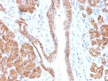 CTNNB1 / Beta Catenin Antibody (clone CTNNB1/1508, Azide-free, BSA-free)